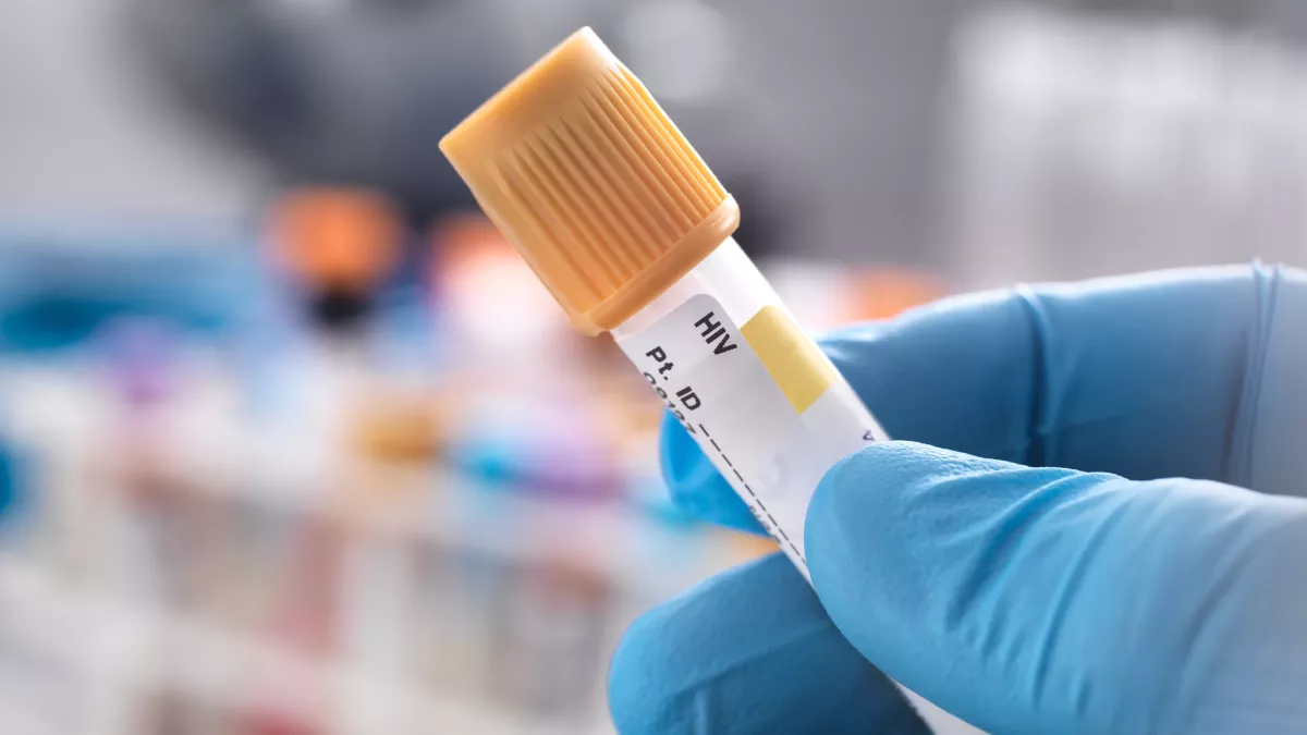 AIDS-Forschung im Durchbruch: Zwei Patienten wurden geheilt