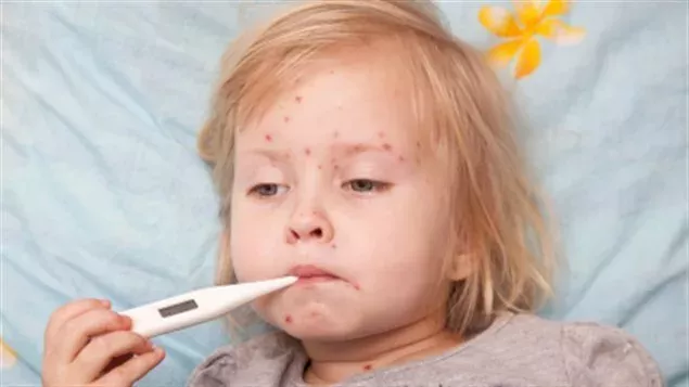 Reye-Syndrom: Symptome, Ursachen, Behandlung