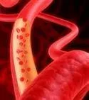 Diabetes mellitus: Typ 1, Typ 2, Symptome, Ernährung, Werte, Ursachen, Diagnose und Behandlung