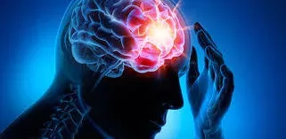 Schlaganfall: Symptome, Anzeichen, Ursachen, Folgen, Test, Therapie und Behandlung