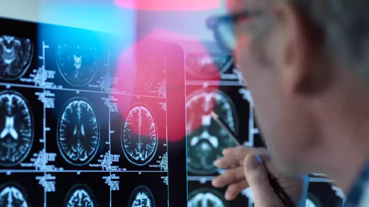 Doctor viewing brain scans for possible disease or damage in clinic 