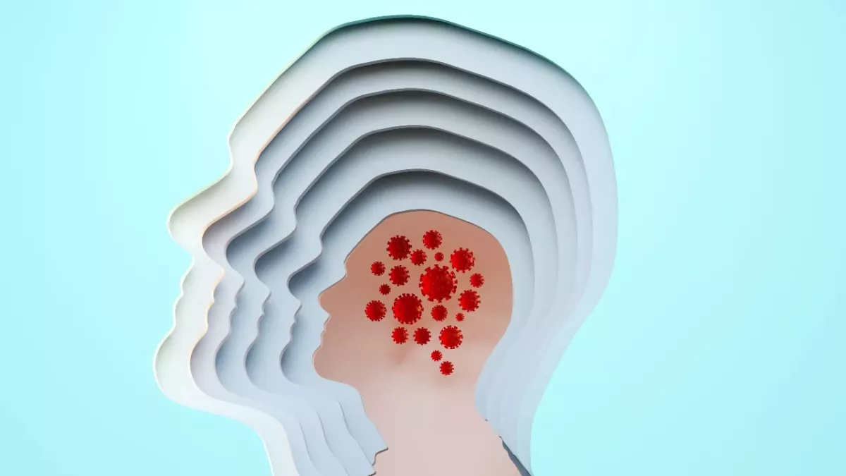 Neuro-Covid