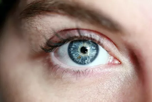Nur acht bis zehn Prozent der Menschen haben blaue Augen