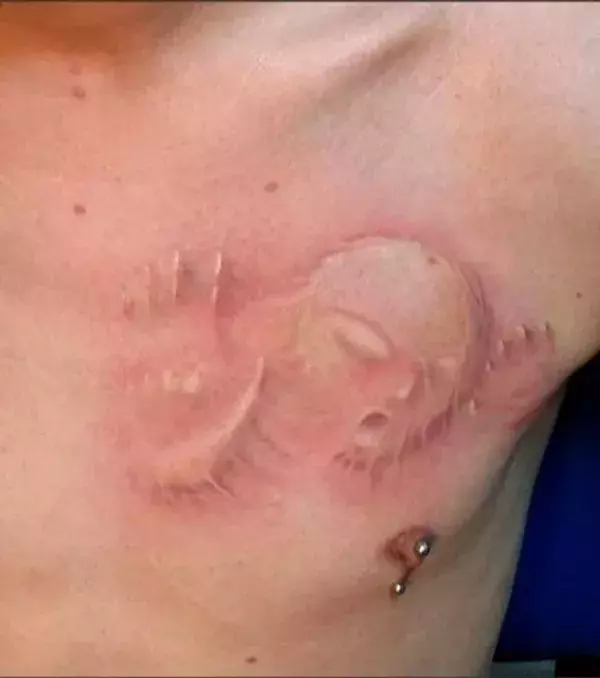 Da will doch jemand aus der Brust herauskommen