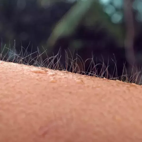 2. Der Haaraufrichtemuskel